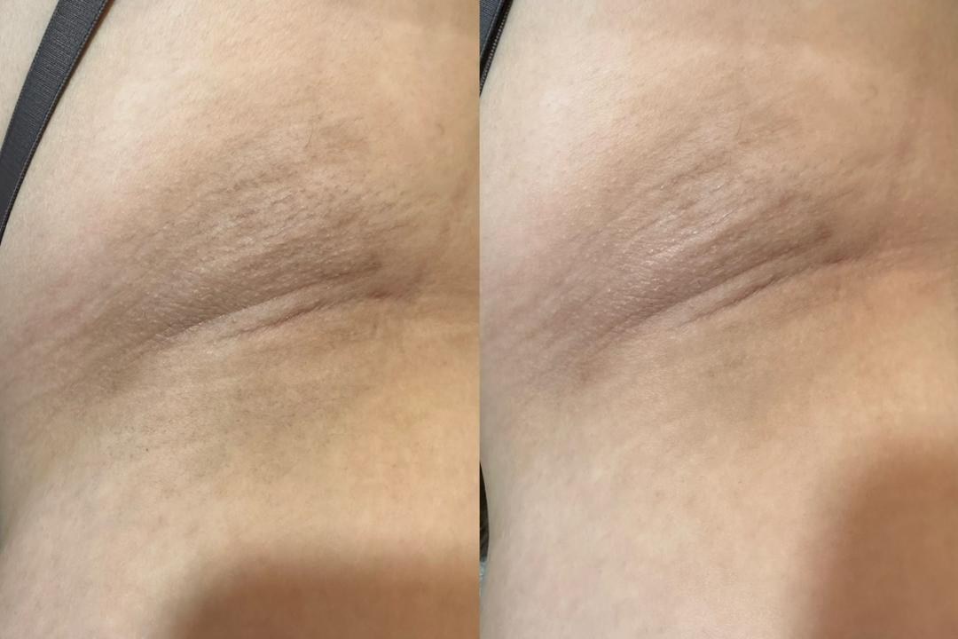 Lumina Glow Brightening result 1