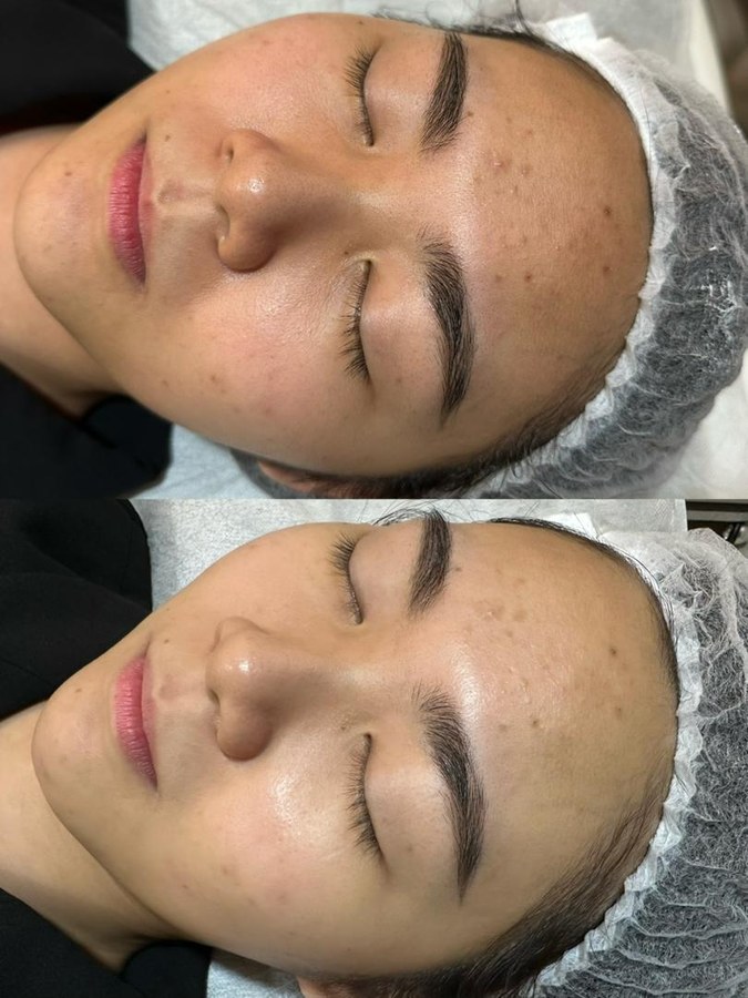 Lumina Glow Brightening result 2