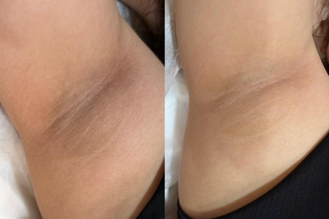 Lumina Glow Brightening result 3